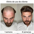 Último dia de promoção: 70% de desconto – 🔥VitaStrands Sérum para Crescimento Capilar