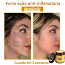 LOVILDS™ Creme Tudo-em-Um com Veneno de Abelha – Aprovado por Dermatologistas dos EUA