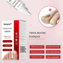 Tratamento para Fungos nas Unhas dos Pés – Solução Extra Forte (Compre 1 Leve 2)