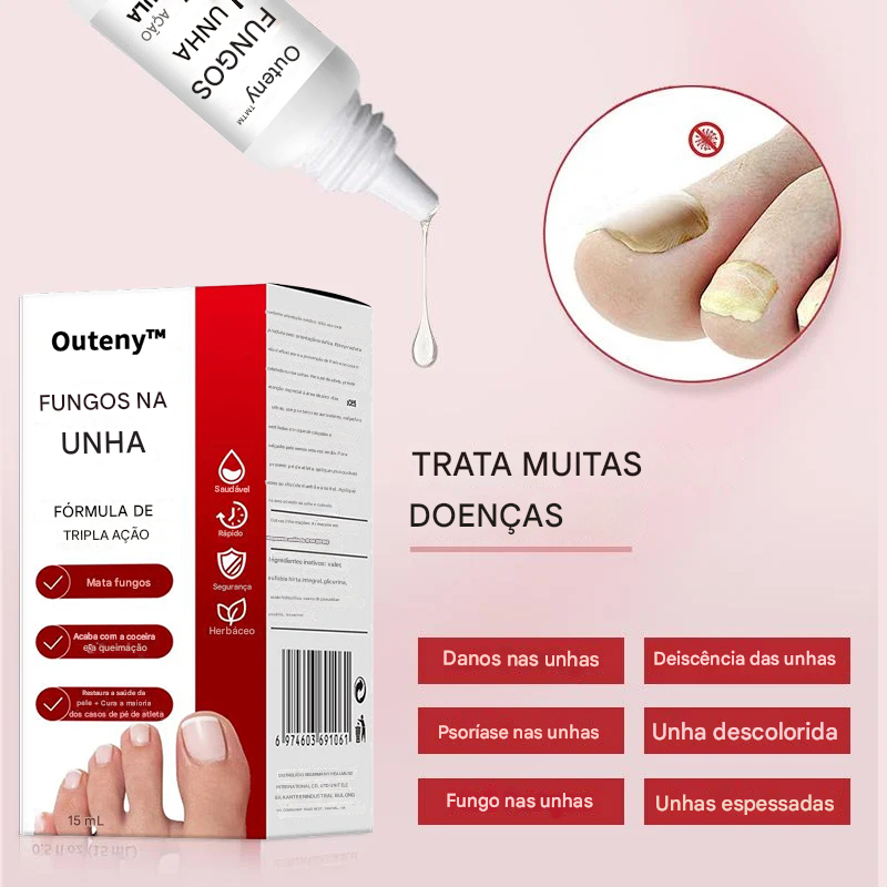 Tratamento para Fungos nas Unhas dos Pés – Solução Extra Forte (Compre 1 Leve 2)