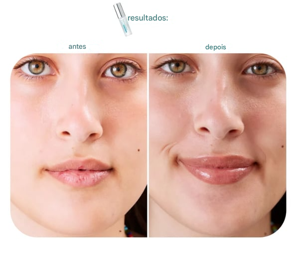 ✨BP Spicule – Sérum Preenchedor Labial (COMPRE 1 LEVE 2)