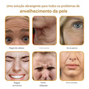 Creme removedor de rugas Botox Bee Venom - 🐝 Promoção relâmpago: só hoje!