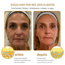 Creme removedor de rugas Botox Bee Venom - 🐝 Promoção relâmpago: só hoje!