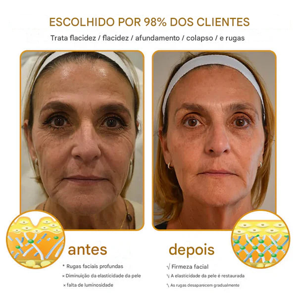 Creme removedor de rugas Botox Bee Venom - 🐝 Promoção relâmpago: só hoje!