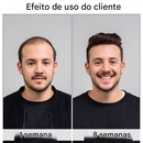 Último dia de promoção: 70% de desconto – 🔥VitaStrands Sérum para Crescimento Capilar