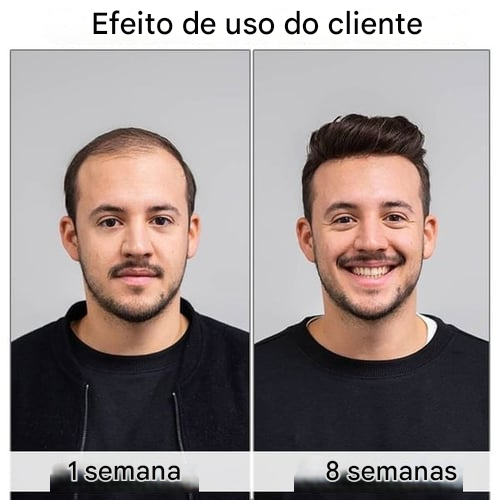 Último dia de promoção: 70% de desconto – 🔥VitaStrands Sérum para Crescimento Capilar