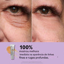 Sérum Instantâneo Firmador para Olhos, nova fórmula, efeito máximo de lifting e suavização (COMPRE 1 LEVE 2)