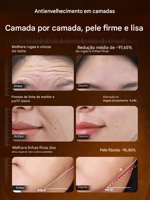 Creme de Essência Elástica de Colágeno Polipeptídico