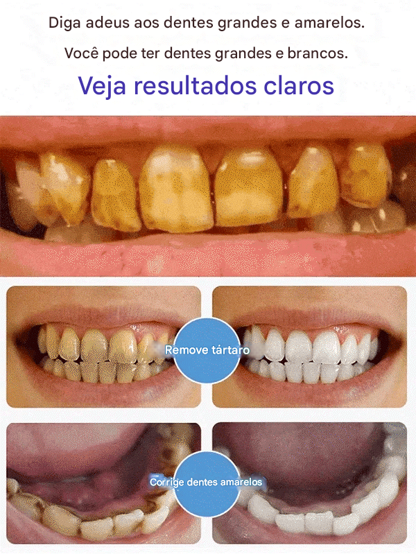 Creme Dental SP-6 (Compre 1 Leve 2)