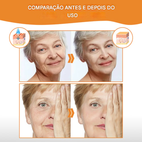 Novo Conjunto de Essência Instantânea de Colágeno para a Pele. (COMPRE 1 LEVE 2)