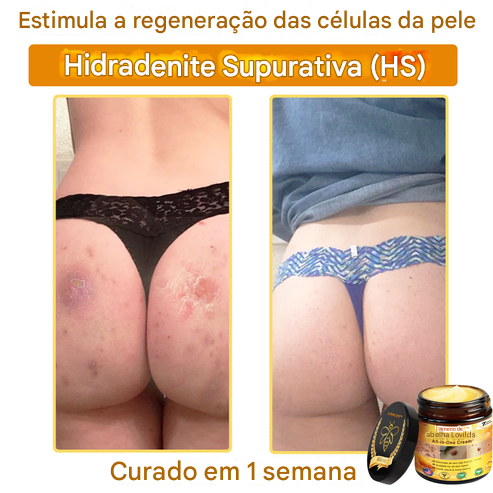 LOVILDS™ Creme Tudo-em-Um com Veneno de Abelha – Aprovado por Dermatologistas dos EUA
