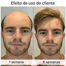 Último dia de promoção: 70% de desconto – 🔥VitaStrands Sérum para Crescimento Capilar