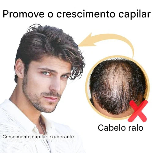 Spray de Essência para Crescimento Capilar com Biotina Biancat™ (Nova Fórmula)