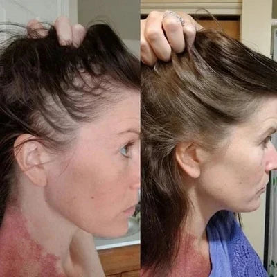 Spray de Essência para Crescimento Capilar com Biotina Biancat™ (Nova Fórmula)