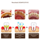 Creme Dental SP-6 (Compre 1 Leve 2)