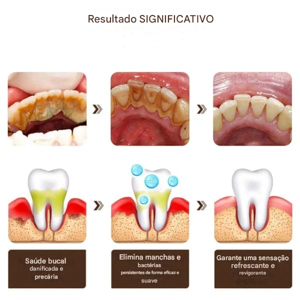 Creme Dental SP-6 (Compre 1 Leve 2)