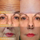 🔥Creme facial firmador polipeptídico