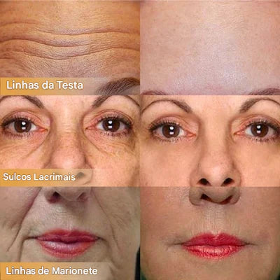 🔥Creme facial firmador polipeptídico