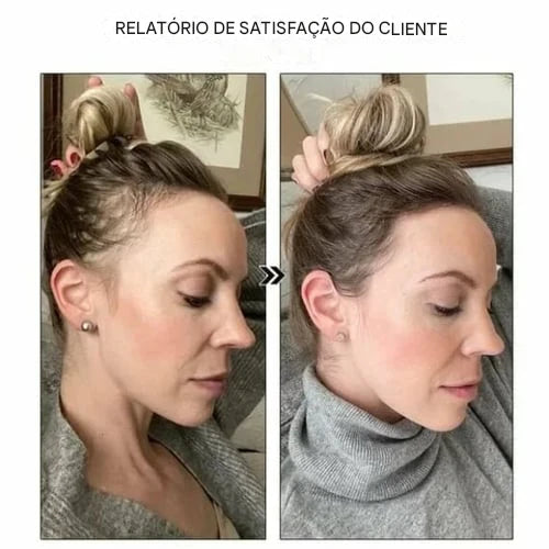 Spray de Essência para Crescimento Capilar com Biotina Biancat™ (Nova Fórmula)