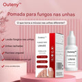 Tratamento para Fungos nas Unhas dos Pés – Solução Extra Forte (Compre 1 Leve 2)